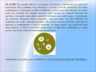 05.(UFRJ) Um grande número de doenças do homem é provocado por infecções
bacterianas. Para combater essas infecções, é comum o uso de antibióticos. O exame
antibiograma é usado para escolher o antibiótico correto para cada infecção. O exame
pode ser resumido da seguinte maneira: uma amostra do material infectado do
paciente é semeada numa placa contendo nutrientes necessários para o crescimento
das bactérias. Pequenos discos contendo, cada um deles, um tipo diferente de
antibiótico são então colocados na placa. Decorrido o tempo necessário para que as
bactérias se multipliquem, a placa é analisada. Na figura abaixo, que representa uma
dessas placas, os discos com letras representam os diferentes antibióticos e a zona
escura representa a área de crescimento das bactérias. 
Analisando essa placa, que antibióticos você receitaria ao paciente? Justifique.
 