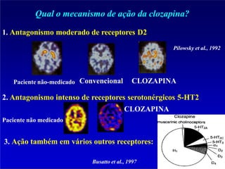 Qual o mecanismo de ação da clozapina?
Convencional CLOZAPINA
Paciente não-medicado
1. Antagonismo moderado de receptores D2
Pilowsky et al., 1992
2. Antagonismo intenso de receptores serotonérgicos 5-HT2
CLOZAPINA
Paciente não medicado
3. Ação também em vários outros receptores:
Busatto et al., 1997
 