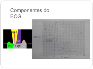 Componentes do
ECG
 