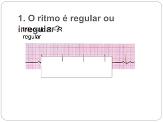 1. O ritmo é regular ou
irregular? Intervalo R – R
regular
 