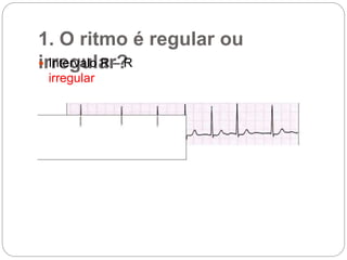 1. O ritmo é regular ou
irregular? Intervalo R – R
irregular
 