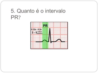 5. Quanto é o intervalo
PR?
 