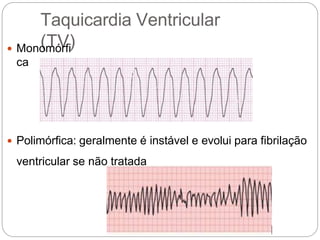 Taquicardia Ventricular
(TV) Monomórfi
ca
 Polimórfica: geralmente é instável e evolui para fibrilação
ventricular se não tratada
 