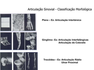Articulação Sinovial - Classificação Morfológica
Plana – Ex: Articulação Intertársica
Gínglimo– Ex: Articulação Interfalângicas
Articulação do Cotovelo
Trocóidea – Ex: Articulação Rádio
Ulnar Proximal
 