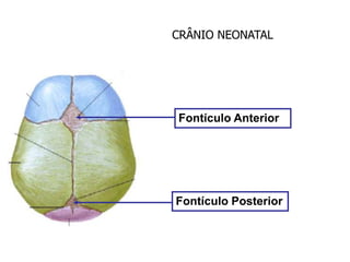 CRÂNIO NEONATAL
Fontículo Anterior
Fontículo Posterior
 