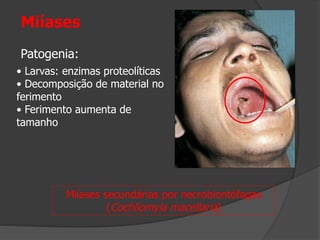 Miíases
Patogenia:
• Larvas: enzimas proteolíticas
• Decomposição de material no
ferimento
• Ferimento aumenta de
tamanho
Miíases secundárias por necrobiontófagas
(Cochliomyia macellaria)
 