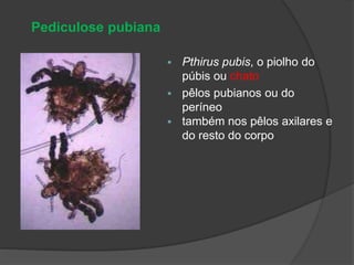  Pthirus pubis, o piolho do
púbis ou chato
 pêlos pubianos ou do
períneo
 também nos pêlos axilares e
do resto do corpo
Pediculose pubiana
 