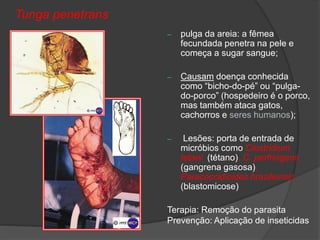 Tunga penetrans
– pulga da areia: a fêmea
fecundada penetra na pele e
começa a sugar sangue;
– Causam doença conhecida
como “bicho-do-pé” ou “pulga-
do-porco” (hospedeiro é o porco,
mas também ataca gatos,
cachorros e seres humanos);
– Lesões: porta de entrada de
micróbios como Clostridium
tetani (tétano), C. perfringens
(gangrena gasosa),
Paracoccidioides braziliensis
(blastomicose)
Terapia: Remoção do parasita
Prevenção: Aplicação de inseticidas
 