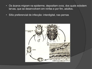 • Os ácaros migram na epiderme, depositam ovos, dos quais eclodem
larvas, que se desenvolvem em ninfas e por fim, adultos.
• Sítio preferencial de infecção: interdigital, nas pernas
 