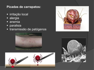 Picadas de carrapatos:
 irritação local
 alergia
 anemia
 paralisia
 transmissão de patógenos
 