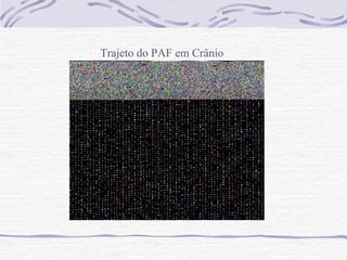 Trajeto do PAF em Crânio

 