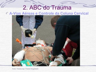 2. ABC do Trauma
A-Vias Aéreas e Controle da Coluna Cervical

Fonte: Trauma.org ( Trauma Imagebank)

 