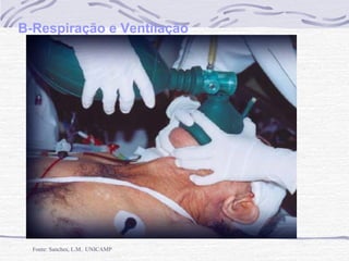 B-Respiração e Ventilação

Fonte: Sanches, L.M. UNICAMP

 