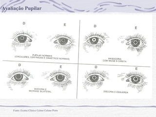 Avaliação Pupilar

Fonte: Exame Clínico Celmo Celeno Porto

 