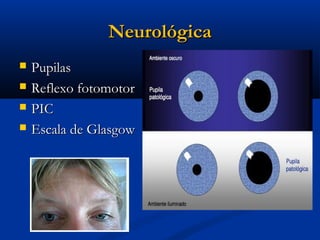 Neurológica
   Pupilas
   Reflexo fotomotor
   PIC
   Escala de Glasgow
 