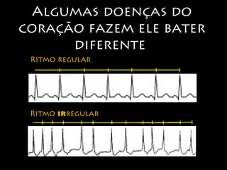 Algumas doenças do 
coração fazem ele bater 
diferente 
Ritmo regular 
Ritmo irregular 
 