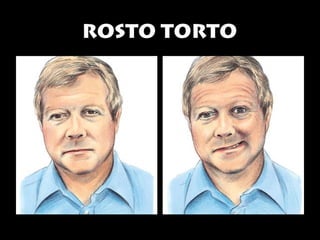 RROOSSTTOO TTOORRTTOO 
 