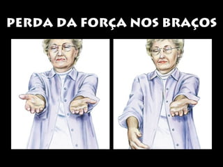 PPEERRDDAA DDAA FFOORRÇÇAA NNOOSS BBRRAAÇÇOOSS 
 