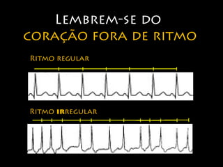 Lembrem-se do 
coração fora de ritmo 
Ritmo regular 
Ritmo irregular 
 