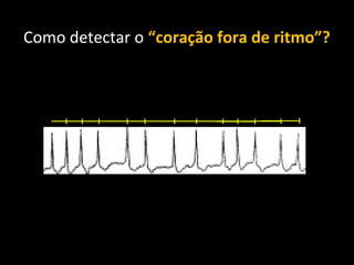 Como detectar o “coração fora de ritmo”? 
 