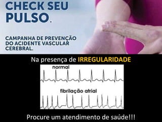 Na presença de IRREGULARIDADE 
Procure um atendimento de saúde!!! 
 