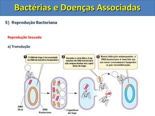 Bactérias e Doenças AssociadasBactérias e Doenças Associadas
Reprodução Sexuada
a) Transdução
 