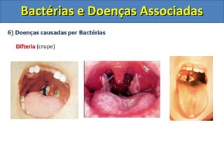 Bactérias e Doenças AssociadasBactérias e Doenças Associadas
 