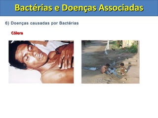 6) Doenças causadas por Bactérias
CóleraCólera
Bactérias e Doenças AssociadasBactérias e Doenças Associadas
 