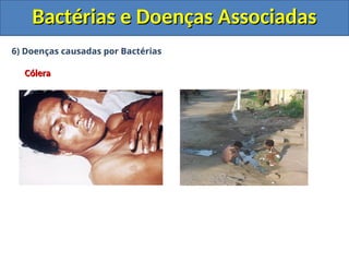 6) Doenças causadas por Bactérias
Cólera
Cólera
Bactérias e Doenças Associadas
Bactérias e Doenças Associadas
 