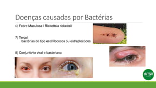 Doenças causadas por Bactérias
6) Febre Maculosa / Rickettsia rickettsii
7) Terçol
bactérias do tipo estafilococos ou estreptococos
8) Conjuntivite viral e bacteriana
 