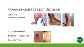 Doenças causadas por Bactérias
15) Erisipela
Streptococcus pyogenes
16) Tifo ‡ Febre tifóide
Rickettsias → pulgas e piolhos
Salmonella Typhi
 