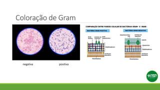 Coloração de Gram
negativa positiva
 