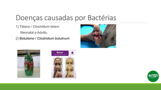 Doenças causadas por Bactérias
1) Tétano / Clostridium tetani:
Neonatal e Adulto.
2) Botulismo / Clostridium botulinum
 