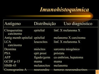 Imunohistoquimica  Antígeno Distribuição  Uso diagnóstico Citoqueratina  epitelial linf. X melanoma X carcinoma Antig memb epitelial epitelial melanoma X carcinoma LCA leucocitos linf. X melanoma X carcinoma Desmina miócitos sarcoma miogênico PSA epit prost próstata AFP figado/germ ca embrion, hepatoma GCDF p-15 mama mama HMB-45 melanocitos melanoma Cromogranina A neuroendoc tumores neuroendocrinos 