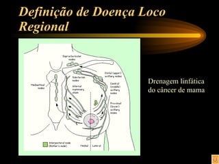 Definição de Doença Loco Regional  Drenagem linfática  do câncer de mama 