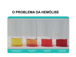 O PROBLEMA DA HEMÓLISE
 