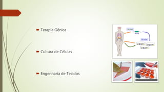  Terapia Gênica
 Cultura de Células
 Engenharia de Tecidos
 