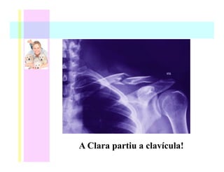 A Clara partiu a clavícula!
 
