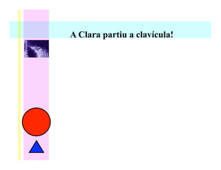 A Clara partiu a clavícula!
 