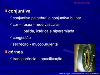 EXAME DA CABEÇA




conjuntiva
conjuntiva palpebral e conjuntiva bulbar
cor – rósea - rede vascular
         pálida, ictérica e hiperemiada
congestão
secreção - mucopurulenta

córnea
transparência – opacificação


                               www.snopes.com/horrors/ techno/cornea.htm
 