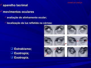 EXAME DA CABEÇA
 aparelho lacrimal

 movimentos oculares
    avaliação do alinhamento ocular;

    localização da luz refletida na córnea;




         Estrabismo;
         Esotropia;
         Exotropia.
 