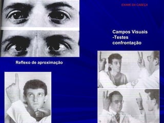 EXAME DA CABEÇA




                         Campos Visuais
                         -Testes
                         confrontação



Reflexo de aproximação
 