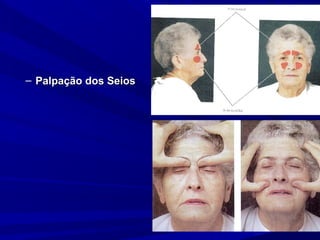 – Palpação dos Seios
 