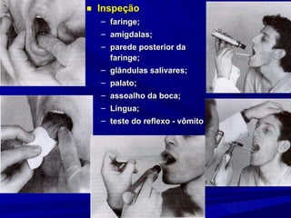 ■ Inspeção
  – faringe;
  – amígdalas;
  – parede posterior da
    faringe;
  – glândulas salivares;
  – palato;
  – assoalho da boca;
  – Língua;
  – teste do reflexo - vômito
 