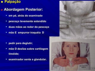 ■ Palpação                             EXAME DO PESCOÇO



   Abordagem Posterior:
     em pé, atrás do examinado

     pescoço levemente estendido

     duas mãos ao redor do pescoço

     mão E empurrar traquéia D



     pedir para deglutir;

     mão D desliza sobre cartilagem
      tireóide;

     examinador sente a glandular.
 