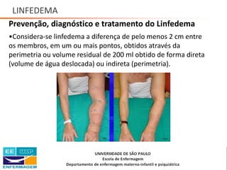 LINFEDEMA
Prevenção, diagnóstico e tratamento do Linfedema
•Considera-se linfedema a diferença de pelo menos 2 cm entre
os membros, em um ou mais pontos, obtidos através da
perimetria ou volume residual de 200 ml obtido de forma direta
(volume de água deslocada) ou indireta (perimetria).
Saúde da Mulher • Profa. Dra. Carla Marins
 