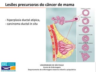 Saúde da Mulher • Profa. Dra. Carla Marins
Lesões precursoras do câncer de mama
- hiperplasia ductal atípica,
- carcinoma ductal in situ
 