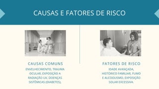 CAUSAS E FATORES DE RISCO
CAUSAS COMUNS
ENVELHECIMENTO, TRAUMA
OCULAR, EXPOSIÇÃO A
RADIAÇÃO UV, DOENÇAS
SISTÊMICAS (DIABETES),
FATORES DE RISCO
IDADE AVANÇADA,
HISTÓRICO FAMILIAR, FUMO
E ALCOOLISMO, EXPOSIÇÃO
SOLAR EXCESSIVA.
 
