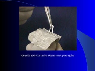 Apreenda a parte da lâmina exposta com o porta-agulha
 