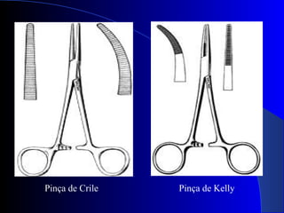 Pinça de KellyPinça de Crile
 